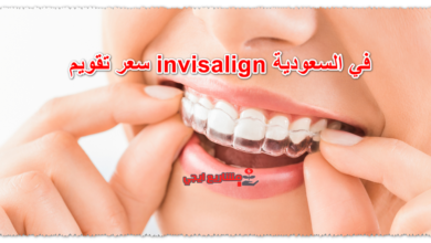 سعر تقويم invisalign في السعودية